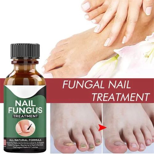 Fast Nail Fungal Treatments Nail Repair (H)