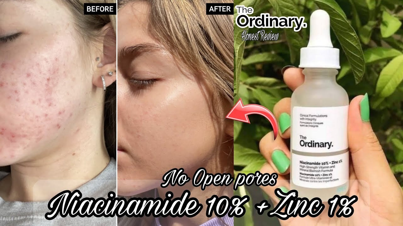 The Ordinary Serum Niacinamide 10% + Zinc 1 % – 30ml