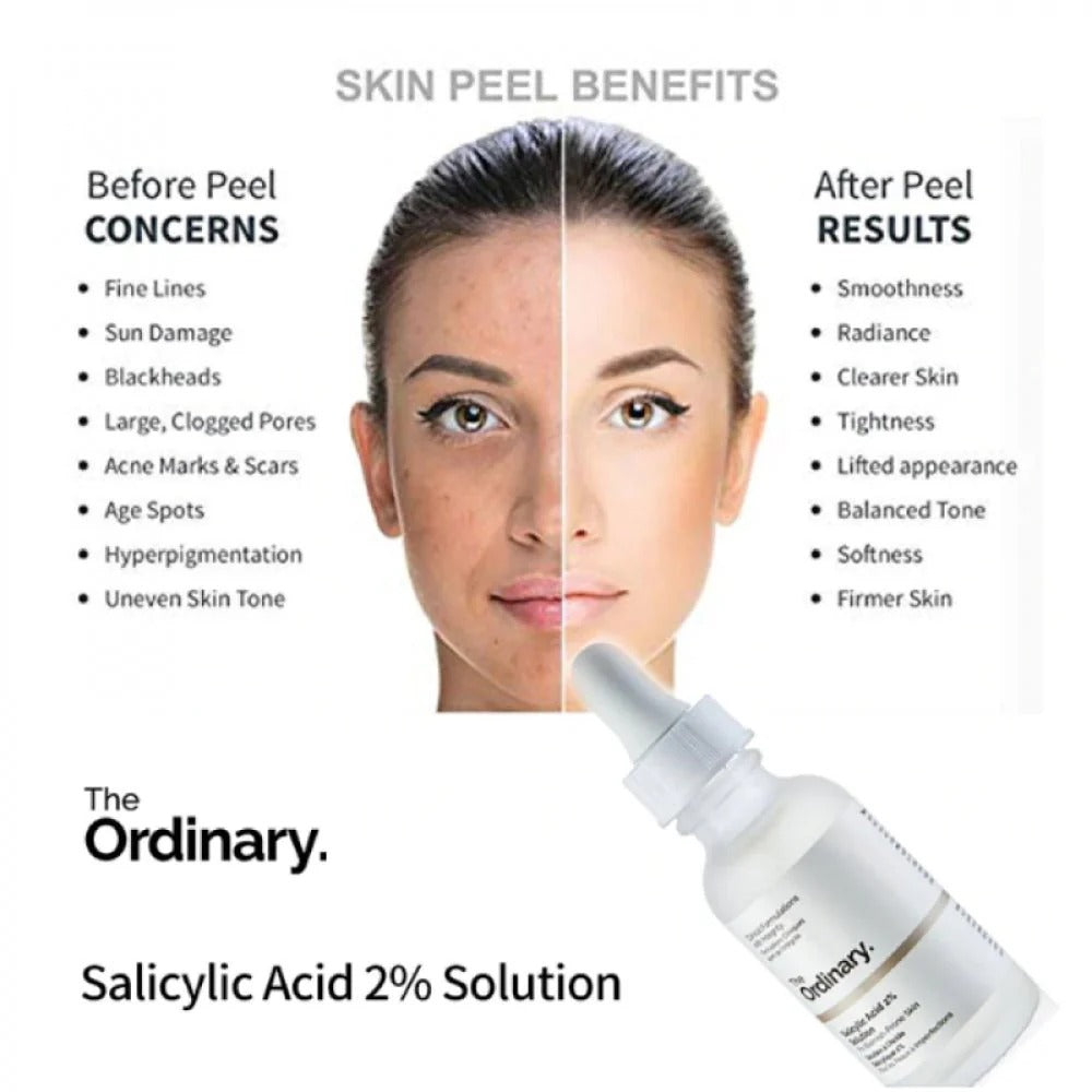 The Ordinary Serum Niacinamide 10% + Zinc 1 % – 30ml