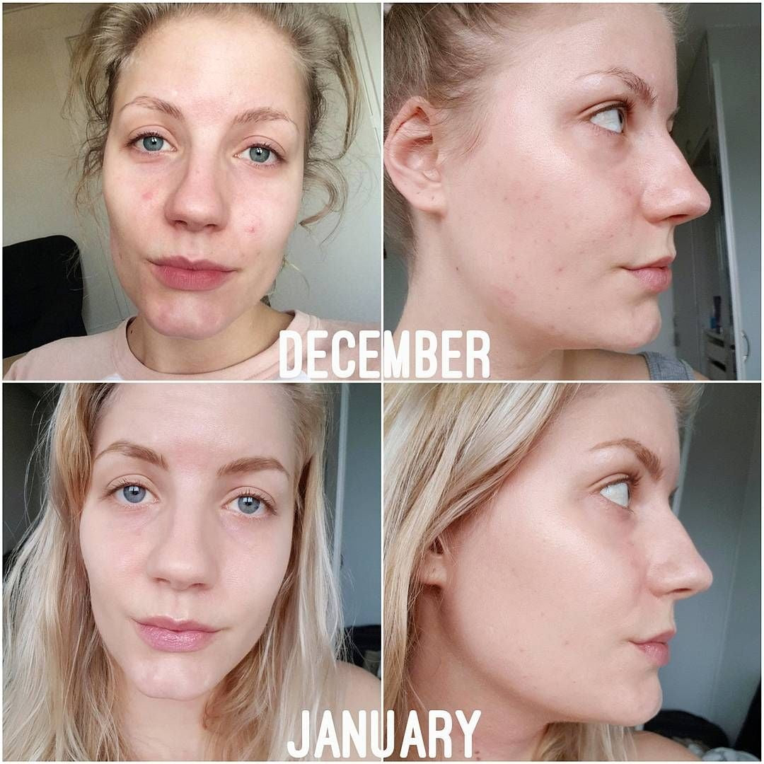 The Ordinary Serum Niacinamide 10% + Zinc 1 % – 30ml